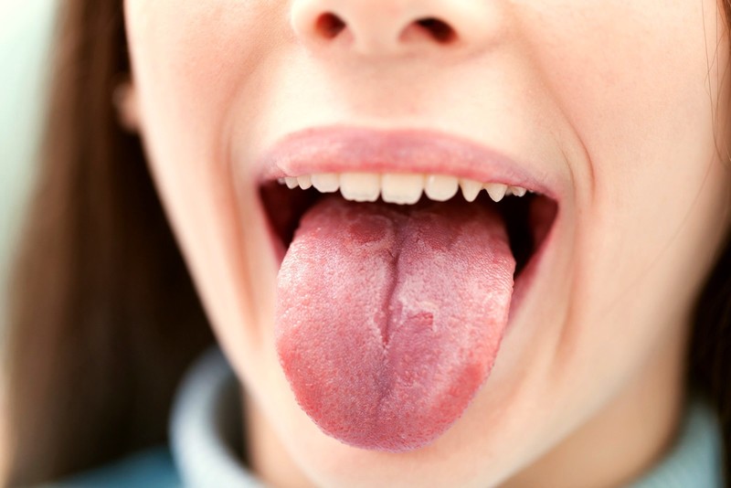 Что делать, если болит язык: как облегчить состояние
