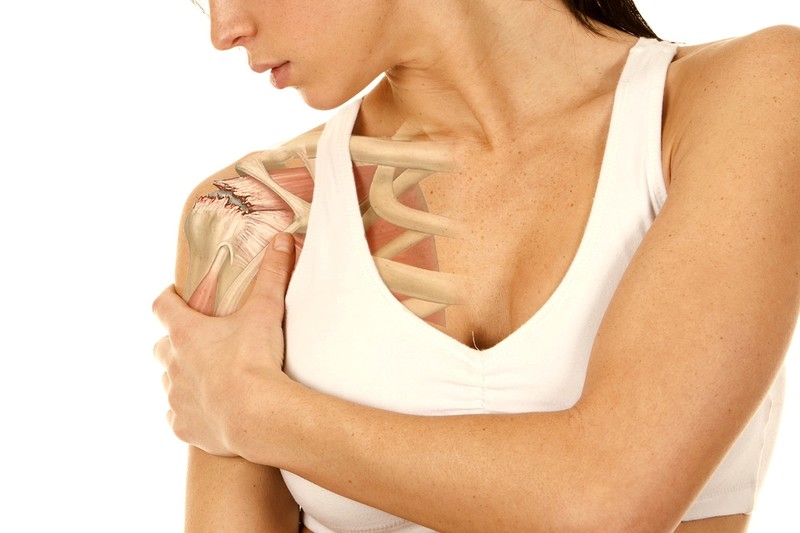 Привычный вывих плеча: причины и лечение