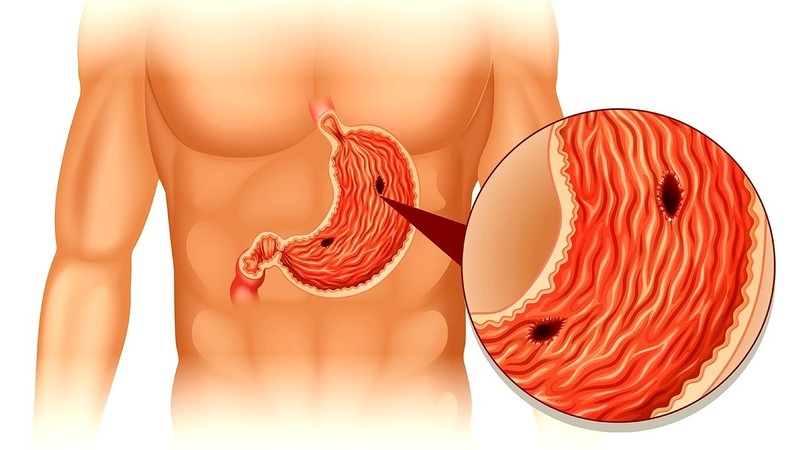 Почему болит желудок и как его лечить — блог ОН Клиник